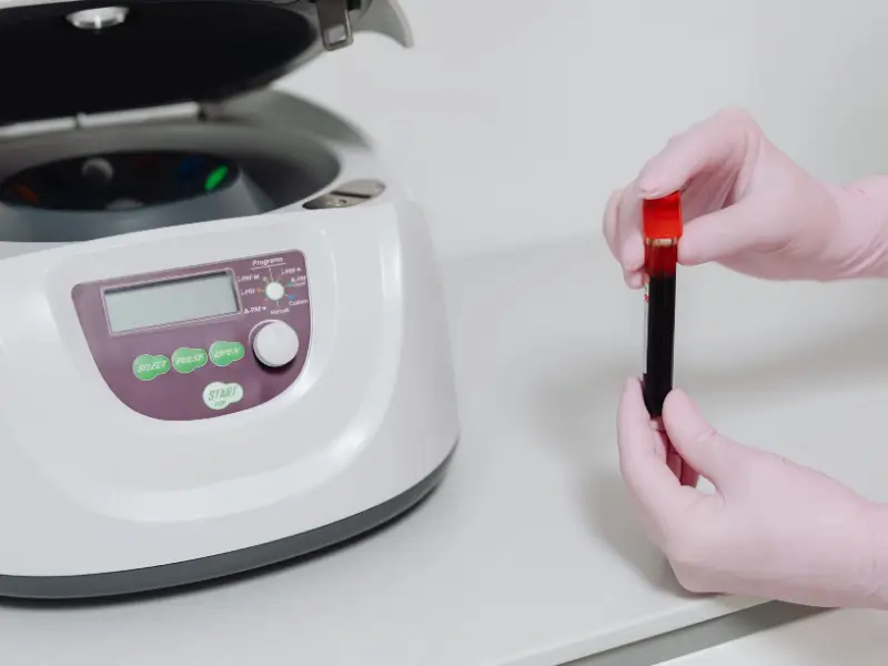 Aplicação de Plasma Rico em Plaquetas (PRP) para rejuvenescimento